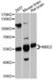 Methyl-CpG Binding Domain Protein 2 antibody, abx126133, Abbexa, Western Blot image 