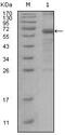 MutS Homolog 6 antibody, GTX83009, GeneTex, Western Blot image 