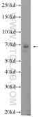 MAU2 Sister Chromatid Cohesion Factor antibody, 24770-1-AP, Proteintech Group, Western Blot image 