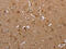 ATPase Sarcoplasmic/Endoplasmic Reticulum Ca2+ Transporting 1 antibody, CSB-PA188650, Cusabio, Immunohistochemistry frozen image 