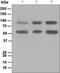 Doublecortin Like Kinase 1 antibody, ab109029, Abcam, Western Blot image 