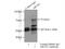 ATP Binding Cassette Subfamily D Member 2 antibody, 18179-1-AP, Proteintech Group, Immunoprecipitation image 