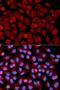 Mitogen-Activated Protein Kinase 9 antibody, LS-C335141, Lifespan Biosciences, Immunofluorescence image 