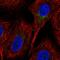 Solute Carrier Family 35 Member C1 antibody, HPA064001, Atlas Antibodies, Immunofluorescence image 