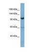 Gem Nuclear Organelle Associated Protein 4 antibody, NBP1-52913, Novus Biologicals, Western Blot image 
