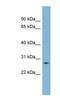 Guanidinoacetate N-methyltransferase antibody, NBP1-54399, Novus Biologicals, Western Blot image 