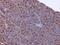 Acyl-CoA Synthetase Long Chain Family Member 4 antibody, GTX632675, GeneTex, Immunohistochemistry paraffin image 