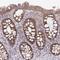 Glutathione S-Transferase Mu 1 antibody, NBP2-46828, Novus Biologicals, Immunohistochemistry frozen image 