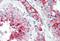 Basigin (Ok Blood Group) antibody, NB500-430, Novus Biologicals, Immunohistochemistry paraffin image 