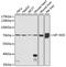 Mitochondrially Encoded NADH:Ubiquinone Oxidoreductase Core Subunit 5 antibody, 18-177, ProSci, Western Blot image 