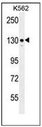 Integrin Subunit Alpha 8 antibody, AP52252PU-N, Origene, Western Blot image 