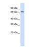 Interferon Regulatory Factor 2 Binding Protein 1 antibody, NBP1-55309, Novus Biologicals, Western Blot image 