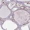 Nucleoporin NUP188 homolog antibody, PA5-63984, Invitrogen Antibodies, Immunohistochemistry frozen image 