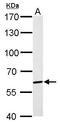 P21 (RAC1) Activated Kinase 1 antibody, GTX111076, GeneTex, Western Blot image 