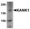 KN motif and ankyrin repeat domain-containing protein 1 antibody, NBP2-81953, Novus Biologicals, Western Blot image 