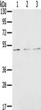 Forkhead Box G1 antibody, TA350672, Origene, Western Blot image 