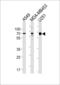 Growth Factor Receptor Bound Protein 10 antibody, LS-C203949, Lifespan Biosciences, Western Blot image 
