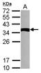 NME/NM23 Family Member 9 antibody, NBP2-15152, Novus Biologicals, Western Blot image 