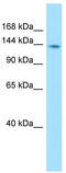 Protein Tyrosine Phosphatase Non-Receptor Type 21 antibody, TA338115, Origene, Western Blot image 