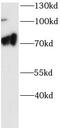 Folliculin antibody, FNab10758, FineTest, Western Blot image 