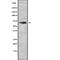 Dual Specificity Tyrosine Phosphorylation Regulated Kinase 3 antibody, abx149952, Abbexa, Western Blot image 