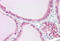 Transient Receptor Potential Cation Channel Subfamily M Member 7 antibody, MBS247133, MyBioSource, Immunohistochemistry frozen image 
