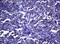 Dedicator Of Cytokinesis 8 antibody, NBP2-46470, Novus Biologicals, Immunohistochemistry paraffin image 