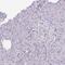 Cyclin B1 antibody, HPA061448, Atlas Antibodies, Immunohistochemistry paraffin image 