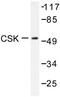 C-Terminal Src Kinase antibody, LS-C176592, Lifespan Biosciences, Western Blot image 