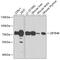 Zinc Finger And BTB Domain Containing 48 antibody, GTX32978, GeneTex, Western Blot image 