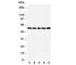 Tachykinin Receptor 1 antibody, R30769, NSJ Bioreagents, Western Blot image 
