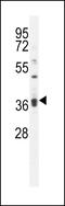 Kelch Like Family Member 35 antibody, LS-C165575, Lifespan Biosciences, Western Blot image 