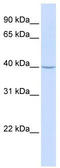 Translocation Associated Membrane Protein 2 antibody, TA341903, Origene, Western Blot image 