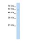 Anaphase Promoting Complex Subunit 7 antibody, NBP1-58224, Novus Biologicals, Western Blot image 