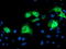 Katanin Regulatory Subunit B1 antibody, TA503724, Origene, Immunofluorescence image 