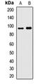 High affinity cAMP-specific and IBMX-insensitive 3 ,5 -cyclic phosphodiesterase 8A antibody, orb411939, Biorbyt, Western Blot image 