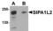 Signal Induced Proliferation Associated 1 Like 2 antibody, TA306877, Origene, Western Blot image 