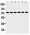 AKT Serine/Threonine Kinase 2 antibody, PB9043, Boster Biological Technology, Western Blot image 