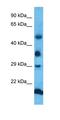 5-Hydroxymethylcytosine Binding, ES Cell Specific antibody, orb326194, Biorbyt, Western Blot image 