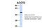 Acyl-CoA Thioesterase 2 antibody, 25-757, ProSci, Western Blot image 