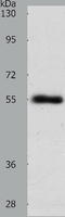 Solute Carrier Family 1 Member 5 antibody, TA322572, Origene, Western Blot image 