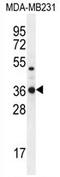 Tryptase Delta 1 antibody, AP54348PU-N, Origene, Western Blot image 