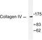 Collagen Type IV Alpha 1 Chain antibody, LS-C175972, Lifespan Biosciences, Western Blot image 