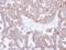 Chaperonin Containing TCP1 Subunit 8 antibody, LS-C185731, Lifespan Biosciences, Immunohistochemistry paraffin image 