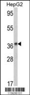 Alcohol Dehydrogenase 1B (Class I), Beta Polypeptide antibody, TA324864, Origene, Western Blot image 