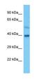 Alcohol Dehydrogenase 5 (Class III), Chi Polypeptide antibody, orb331412, Biorbyt, Western Blot image 