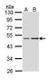 Guanine nucleotide-binding protein G(s) subunit alpha isoforms short antibody, PA5-22261, Invitrogen Antibodies, Western Blot image 