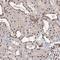 TBC1 Domain Family Member 12 antibody, NBP1-93628, Novus Biologicals, Immunohistochemistry paraffin image 