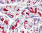 Coagulation factor XIII A chain antibody, 51-855, ProSci, Immunohistochemistry frozen image 