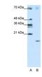 Signal Recognition Particle 19 antibody, NBP1-57425, Novus Biologicals, Western Blot image 